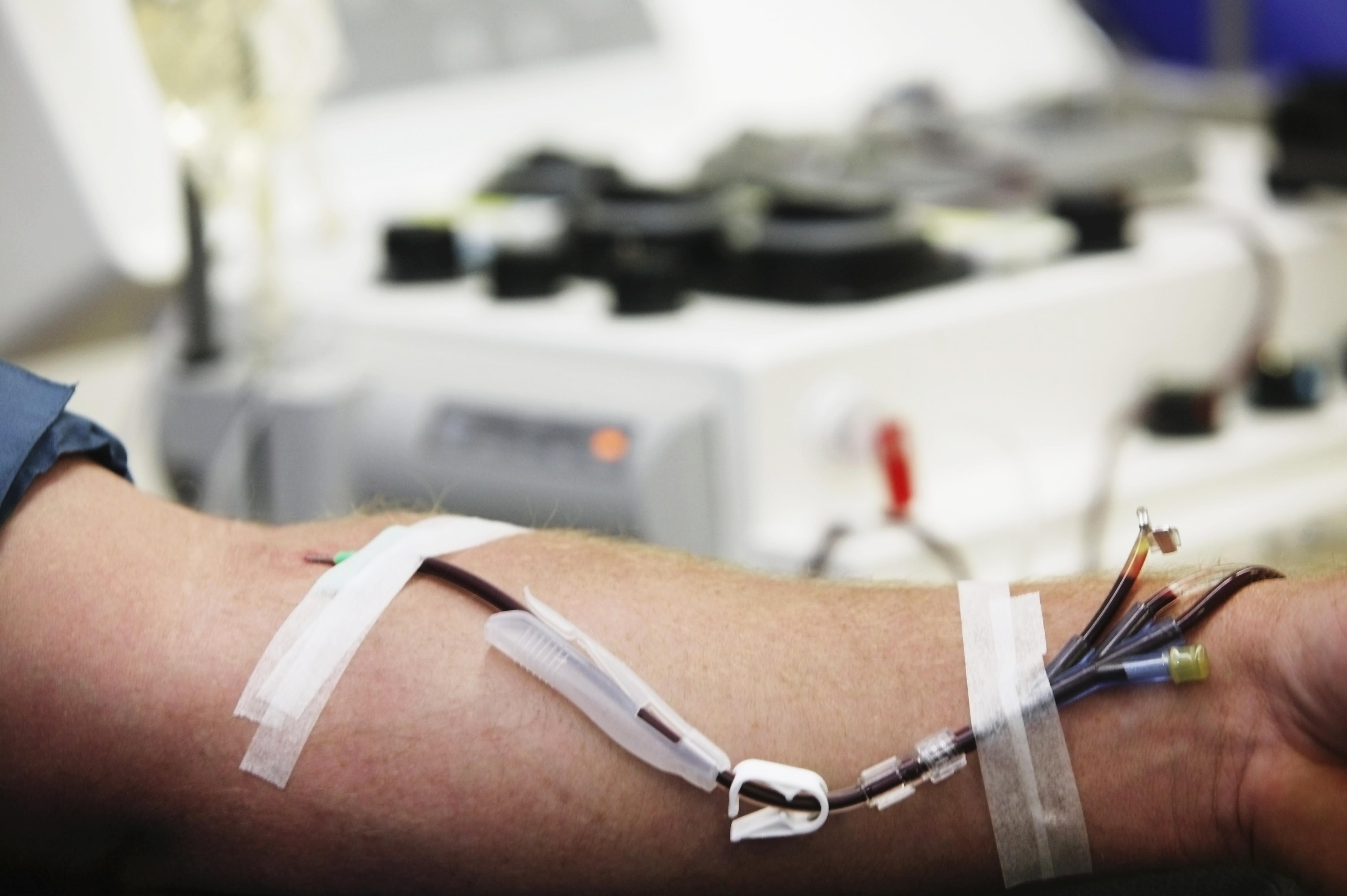 Haemonetics MCS machine