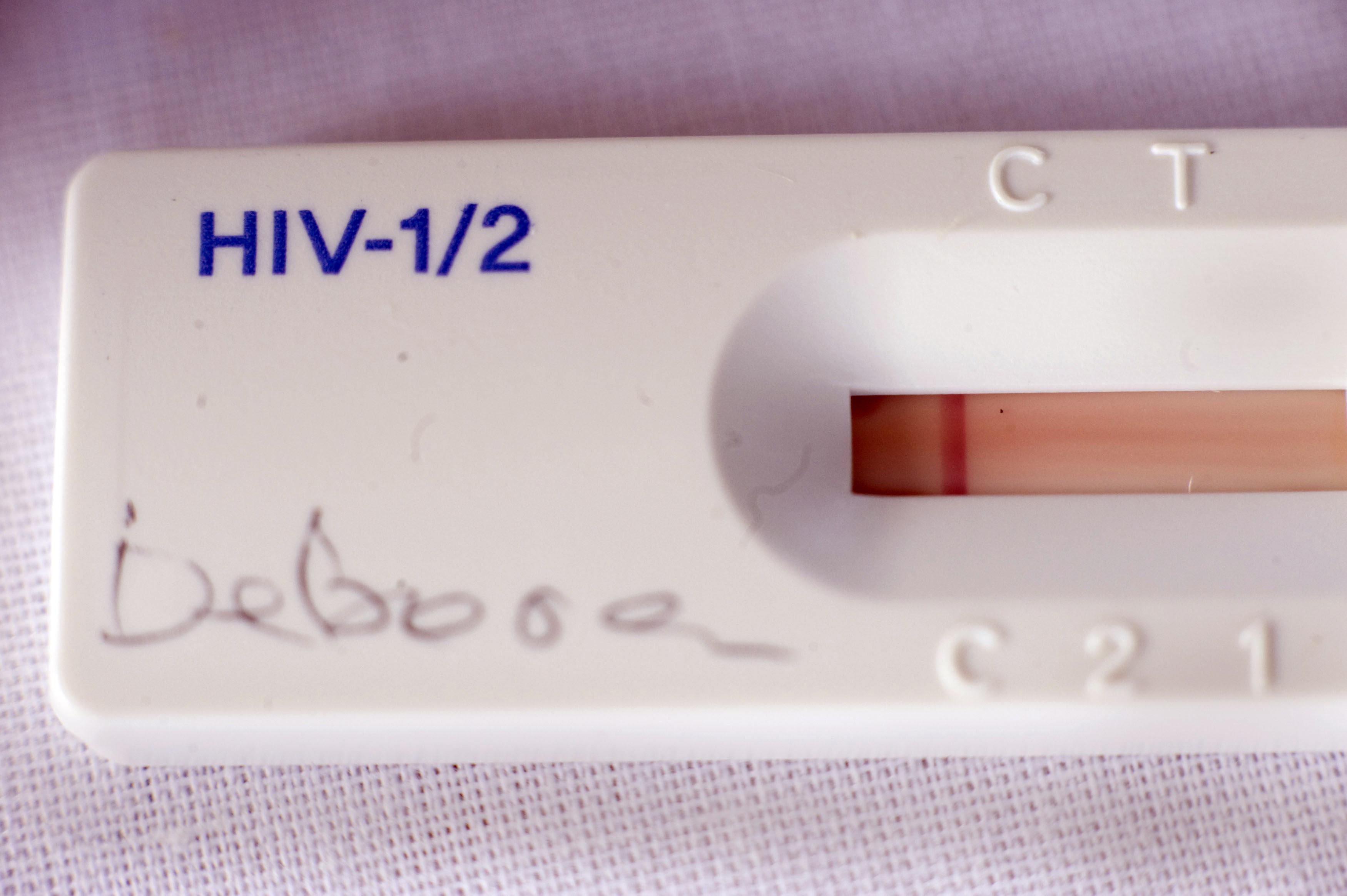 A used HIV's test kit shows a negative r